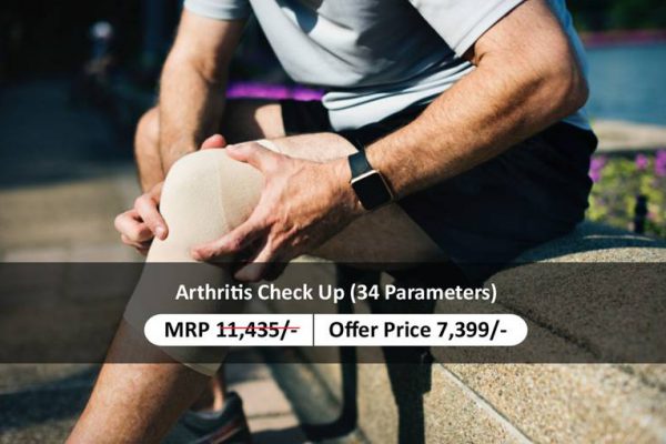 Arthritis Profile Test / Package | 34 Parameters