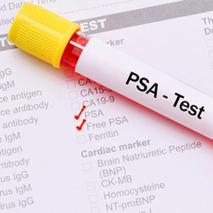 PSA-test