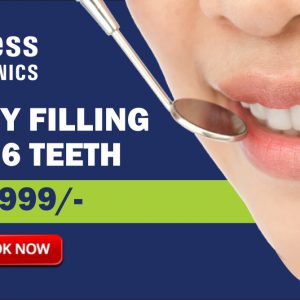 Cavity Filling upto 6 Teeth: Rs. 2,999/-