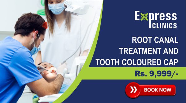 Root Canal Treatment & Tooth Coloured Cap: Rs. 9,999/-