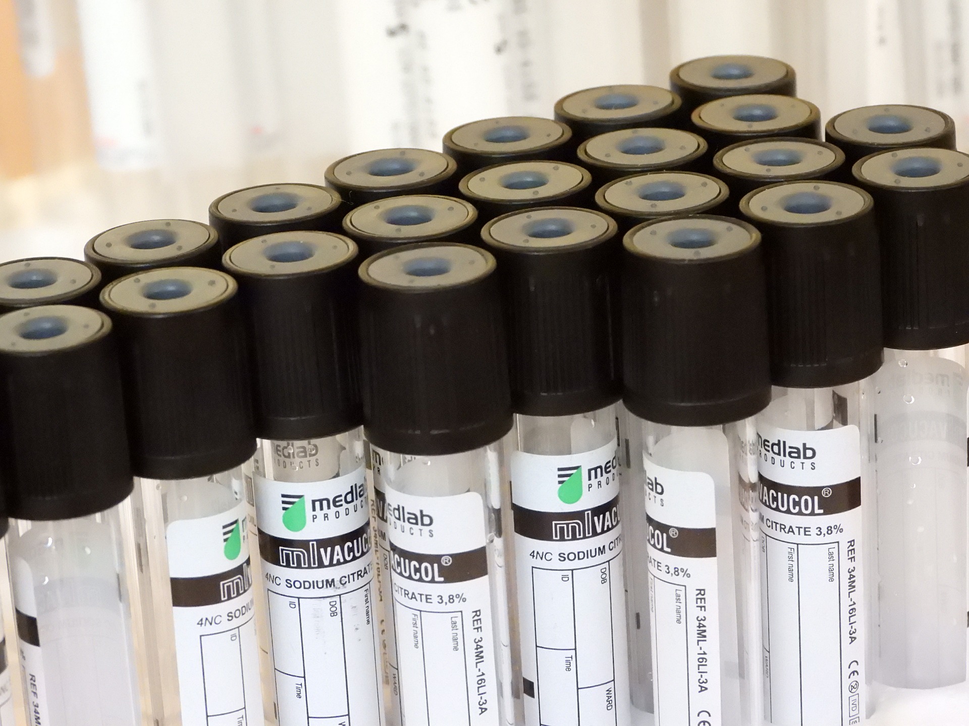 ESR blood test (Erythrocyte Sedimentation Rate) | Express Clinics