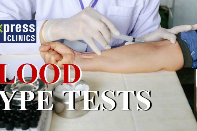Importance of Blood type test, all about ABO Blood type test