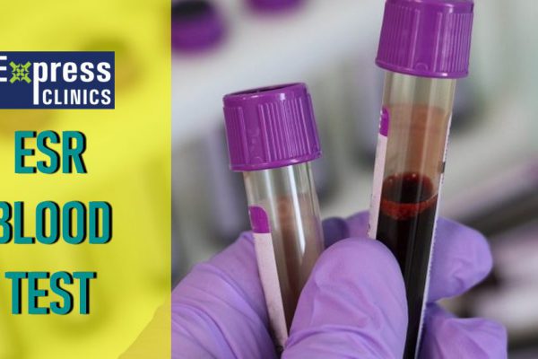 ESR Blood Test – Erythrocyte Sedimentation Rate @ Express Clinics