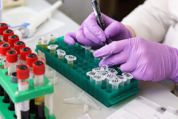 Blood Test Lab in Pune | Diagnostic Centres | Pathology Labs