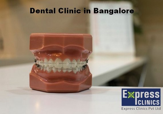 Dental Clinic Bangalore | Best Dental Treatments in Bangalore
