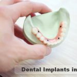 Dentist in Pune | Dental Clinic – Cosmetics and Implant